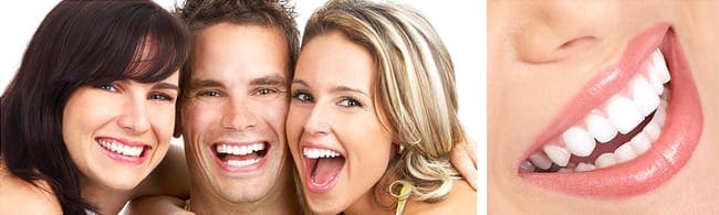Beautiful Smiles of Full Mouth Makeovers Full Mouth Makeovers